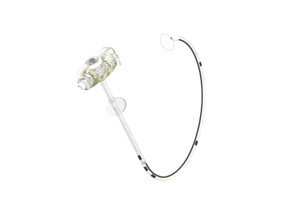 MIC-KEY* GJ-voedingssondes