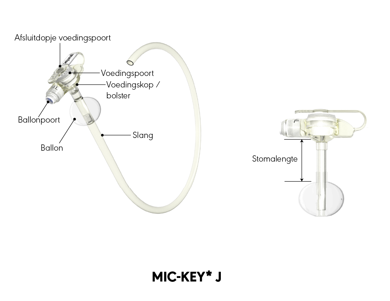 MIC-KEY* J-sonde grafische weergave