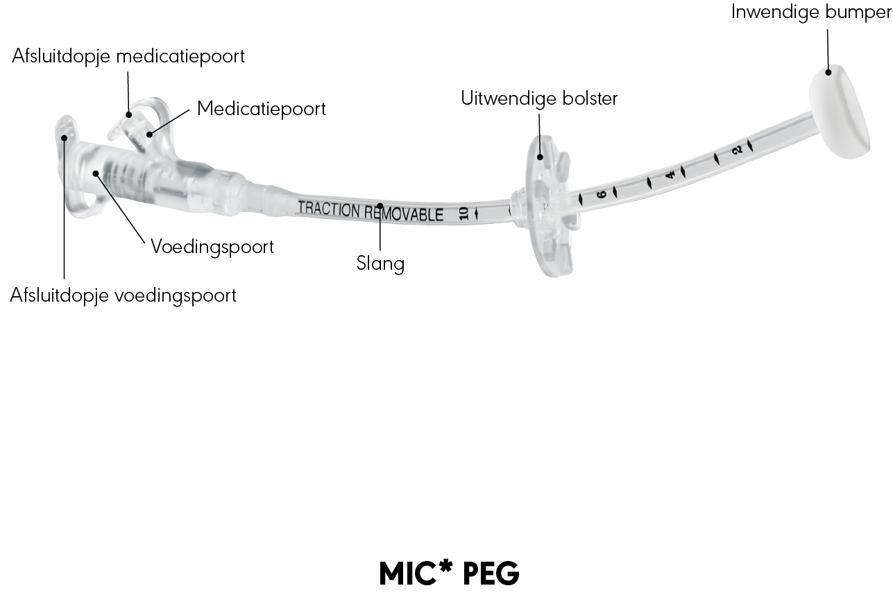 MIC* PEG-sonde grafische weergave